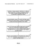 ENERGY-DELIVERY DEVICE INCLUDING ULTRASOUND TRANSDUCER ARRAY AND PHASED     ANTENNA ARRAY, AND METHODS OF ADJUSTING AN ABLATION FIELD RADIATING INTO     TISSUE USING SAME diagram and image