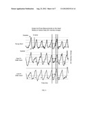 Non-Invasive Optical Imaging for Measuring Pulse and Arterial Elasticity     in the Brain diagram and image