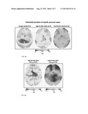Non-Invasive Optical Imaging for Measuring Pulse and Arterial Elasticity     in the Brain diagram and image