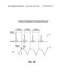 SYSTEMS AND METHODS FOR ESTIMATING CENTRAL ARTERIAL BLOOD PRESSURE OF A     PATIENT diagram and image