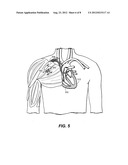 SYSTEMS AND METHODS FOR ESTIMATING CENTRAL ARTERIAL BLOOD PRESSURE OF A     PATIENT diagram and image