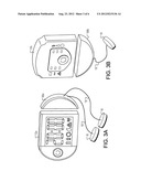 MEDICAL DEVICE diagram and image