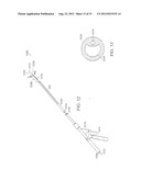 BARIATRIC SLEEVE diagram and image