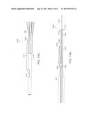 BARIATRIC SLEEVE diagram and image