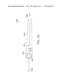 BARIATRIC SLEEVE diagram and image