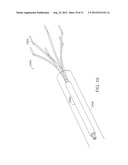 BARIATRIC SLEEVE diagram and image