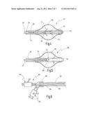 Balloon Catheter With Metal Shaft diagram and image