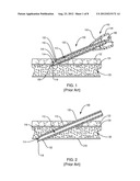 INTRAVASCULAR NEEDLE AND CATHETER ASSEMBLY diagram and image