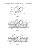 INTRAVASCULAR NEEDLE AND CATHETER ASSEMBLY diagram and image