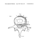 System and Method for Electrical Stimulation of the Lumbar Vertebral     Column diagram and image