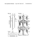 System and Method for Electrical Stimulation of the Lumbar Vertebral     Column diagram and image