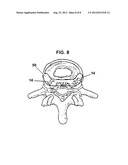 System and Method for Electrical Stimulation of the Lumbar Vertebral     Column diagram and image