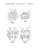 SYSTEM FOR SECURING A PORTION OF A BODY diagram and image