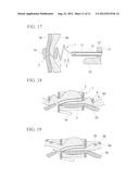 Tissue fastner production method and tissue fastener diagram and image