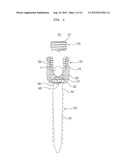 EXTENSIBLE PEDICLE SCREW COUPLING DEVICE diagram and image