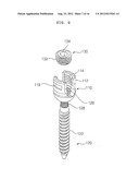 EXTENSIBLE PEDICLE SCREW COUPLING DEVICE diagram and image