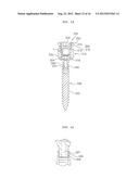 EXTENSIBLE PEDICLE SCREW COUPLING DEVICE diagram and image
