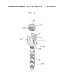 EXTENSIBLE PEDICLE SCREW COUPLING DEVICE diagram and image