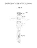 EXTENSIBLE PEDICLE SCREW COUPLING DEVICE diagram and image