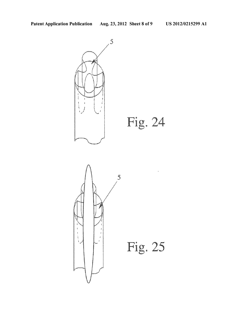 MRT-COMPATIBLE VALVE PROSTHESIS FOR USE IN THE HUMAN OR ANIMAL BODY FOR     REPLACEMENT OF AN ORGAN VALVE OR A VESSEL VALVE - diagram, schematic, and image 09