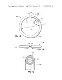 ADJUSTABLE ANNULOPLASTY RING AND ACTIVATION SYSTEM diagram and image