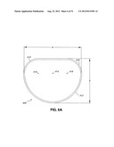 ADJUSTABLE ANNULOPLASTY RING AND ACTIVATION SYSTEM diagram and image