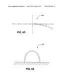 ADJUSTABLE ANNULOPLASTY RING AND ACTIVATION SYSTEM diagram and image