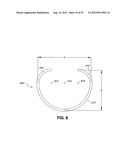 ADJUSTABLE ANNULOPLASTY RING AND ACTIVATION SYSTEM diagram and image