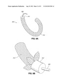 ADJUSTABLE ANNULOPLASTY RING AND ACTIVATION SYSTEM diagram and image