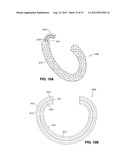 ADJUSTABLE ANNULOPLASTY RING AND ACTIVATION SYSTEM diagram and image