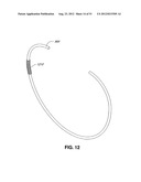 ADJUSTABLE ANNULOPLASTY RING AND ACTIVATION SYSTEM diagram and image