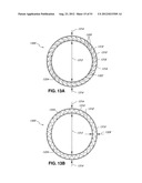 ADJUSTABLE ANNULOPLASTY RING AND ACTIVATION SYSTEM diagram and image