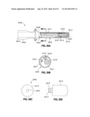 ADJUSTABLE ANNULOPLASTY RING AND ACTIVATION SYSTEM diagram and image