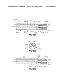 ADJUSTABLE ANNULOPLASTY RING AND ACTIVATION SYSTEM diagram and image