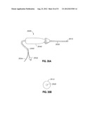 ADJUSTABLE ANNULOPLASTY RING AND ACTIVATION SYSTEM diagram and image