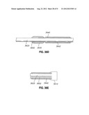 ADJUSTABLE ANNULOPLASTY RING AND ACTIVATION SYSTEM diagram and image