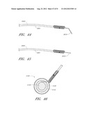 ADJUSTABLE ANNULOPLASTY RING AND ACTIVATION SYSTEM diagram and image