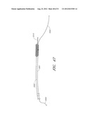 ADJUSTABLE ANNULOPLASTY RING AND ACTIVATION SYSTEM diagram and image