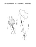 ADJUSTABLE ANNULOPLASTY RING AND ACTIVATION SYSTEM diagram and image