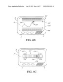 SYSTEMS AND METHODS FOR REPLACING SIGNAL ARTIFACTS IN A GLUCOSE SENSOR     DATA STREAM diagram and image