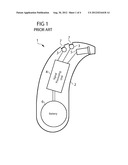 CONFIGURATION AND METHOD FOR THE MAINTENANCE OF HEARING DEVICES diagram and image