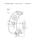 CONFIGURATION AND METHOD FOR THE MAINTENANCE OF HEARING DEVICES diagram and image