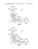 TILED TRANSITION BRACKETING diagram and image