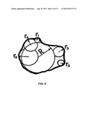 COATING COMPOSITIONS COMPRISING SPHEROID SILICA OR SILICATE diagram and image