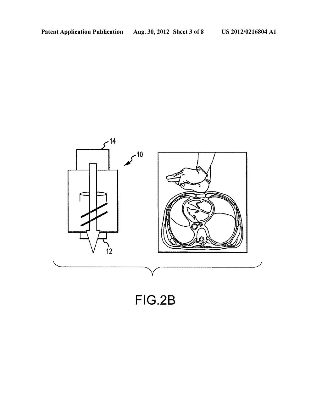 CPR VOLUME EXCHANGER VALVE SYSTEM WITH SAFETY FEATURE AND METHODS - diagram, schematic, and image 04