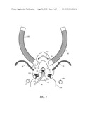 Tube Ventilated Oxygen Mask diagram and image