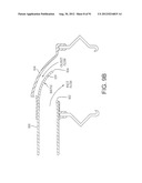 MASK ASSEMBLY diagram and image