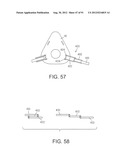 MASK ASSEMBLY diagram and image