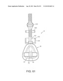 MASK ASSEMBLY diagram and image