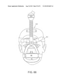 MASK ASSEMBLY diagram and image